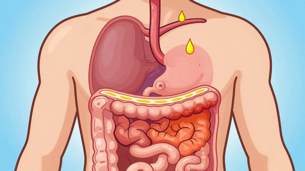 Barrett’s Esophagus: Understanding Dysplasia Risk and Ablation Options